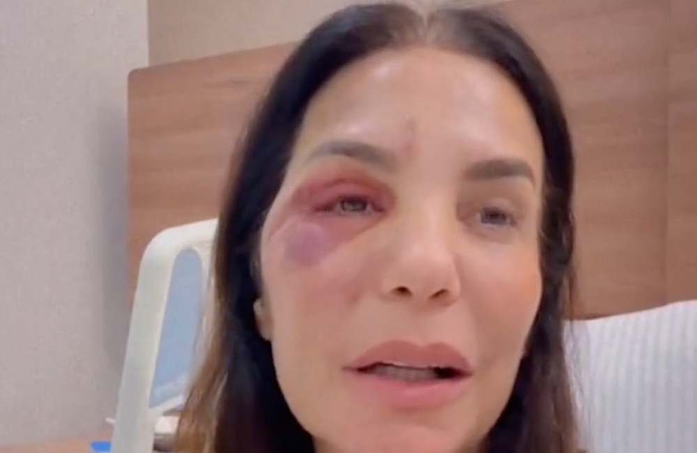 Ex de Ivete Sangalo se pronuncia após cirurgia da cantora: 'Ela está fora de perigo'