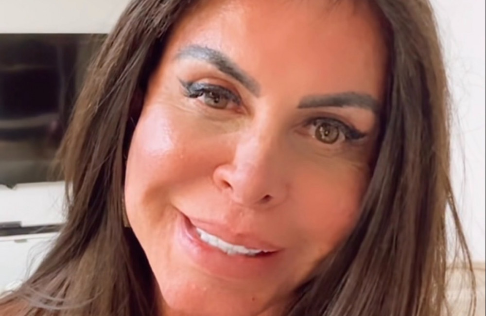 Gretchen fala sobre alopecia progressiva e revela: 'Praticamente não tenho mais cabelo'